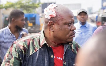 Jean-Marc Kabund : « Voir la police s’associer à des Kulunas munis d’armes blanches pour empêcher une manifestation pacifique de l’opposition est inacceptable »