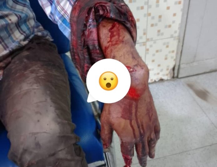 RDC : le président de l’APUKIN réclame l’autorisation de port d’armes pour le corps professoral après l’agression du professeur Denis Bungu