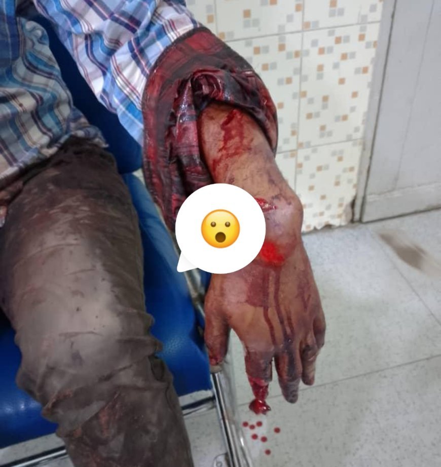 RDC : le président de l’APUKIN réclame l’autorisation de port d’armes pour le corps professoral après l’agression du professeur Denis Bungu