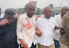 Sit-in de l’opposition : 2 morts et plusieurs blessés [Martin Fayulu]