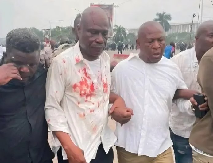 Sit-in de l’opposition : 2 morts et plusieurs blessés [Martin Fayulu]