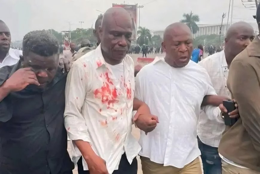 Sit-in de l’opposition : 2 morts et plusieurs blessés [Martin Fayulu]