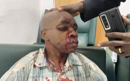 Kinshasa : des blessés lors de l'attaque « à la machette » contre le cortège de Fayulu, la Force du Progrès pointée du doigt
