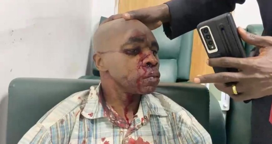 Kinshasa : des blessés lors de l'attaque « à la machette » contre le cortège de Fayulu, la Force du Progrès pointée du doigt