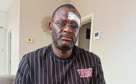 Belgique : le journaliste congolais Claude Pero Luwara violemment agressé à Tirlemont
