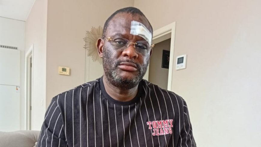 Belgique : le journaliste congolais Claude Pero Luwara violemment agressé à Tirlemont