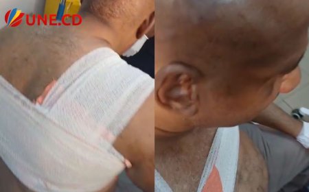 Kinshasa : Gabriel Shabani, le patron de Congo Web TV échappe à la mort après une attaque armée en plein boulevard